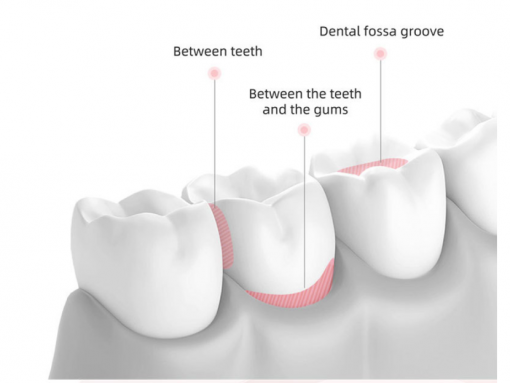 美國Dental Plus - Pro Series電動水牙線 - Image 3