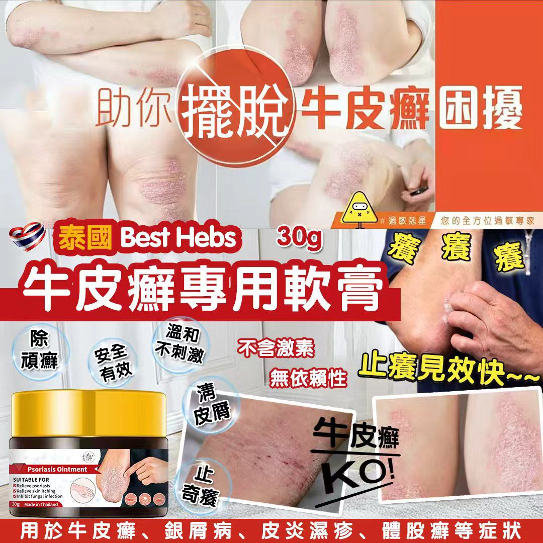 泰國 Best Herbs 牛皮癬濕疹專用軟膏30g